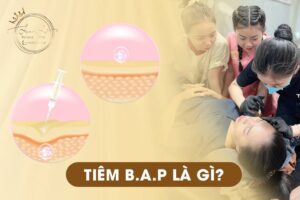 Tiêm BAP Là Gì? Tác Dụng Của Kỹ Thuật Tiêm BAP