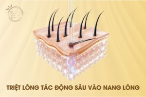 Có Nên Triệt Lông Không?