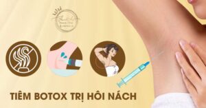 Tiêm botox trị hôi nách 